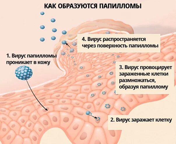 Почему появилось множество