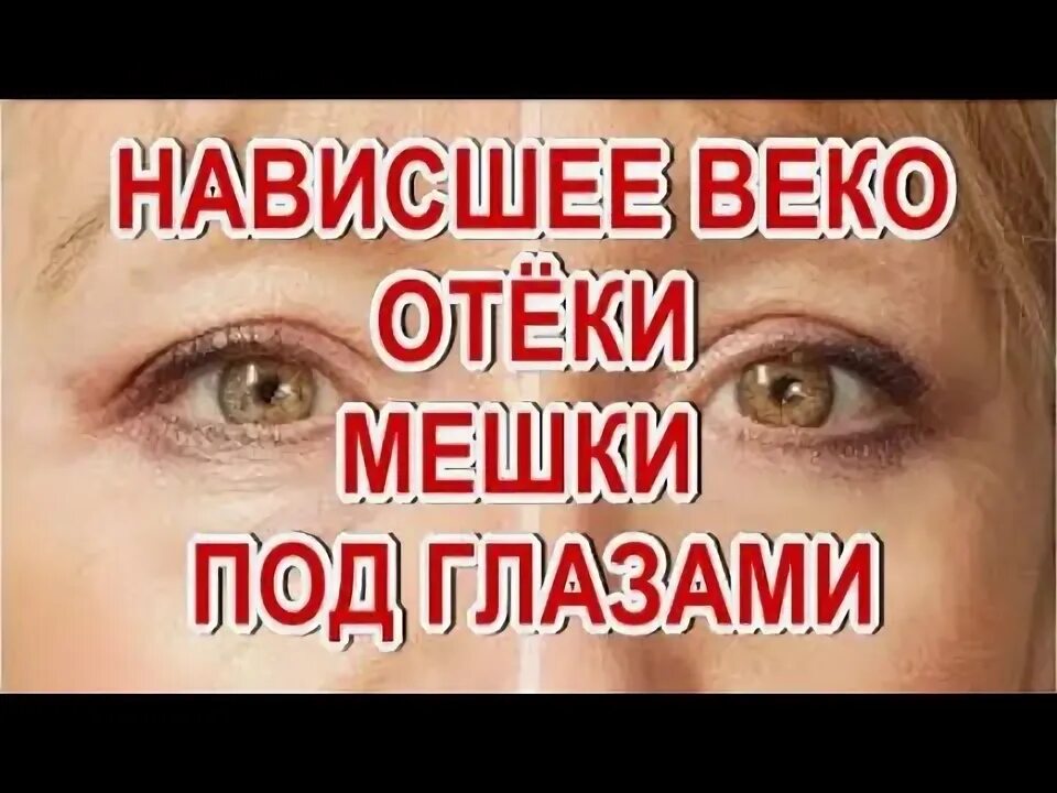 Давление на глаза из-за нависающего века. Школа макияжа жанны сан жак. Видео нависни. Видео нависни. Видео нависни.