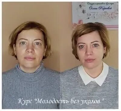 Инъекции екатеринбург