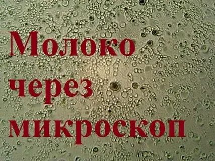 Под микроскопом рассматривают каплю молока