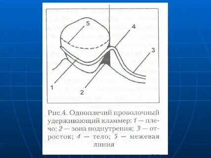 Межевая линия