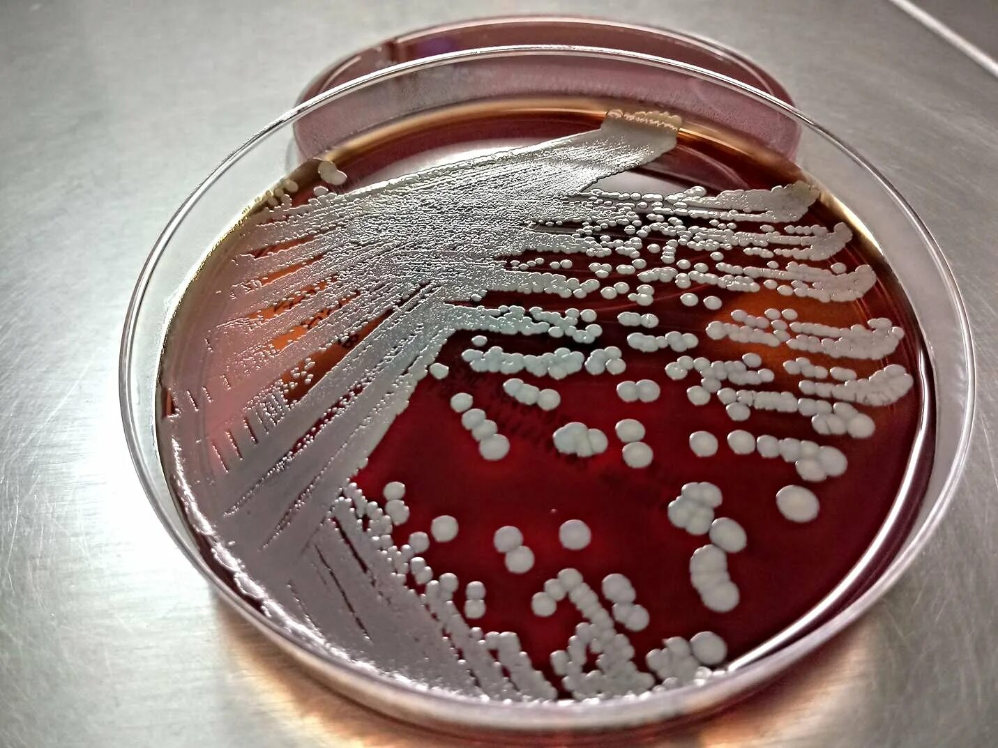 S. aureus золотистый стафилококк. Золотистый стафилококк микробиология. Стафилококк золотистый Staphylococcus aureus. Стафилококк ауреус микробиология. Staphylococcus aureus 4