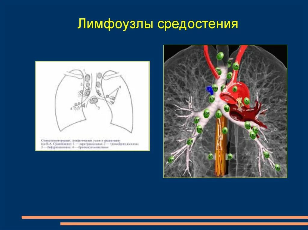 Легкие увеличен узел. Анатомия лимфоузлов средостения на кт. Лимфатические узлы средостения анатомия. Кт анатомия лимфатических узлов средостения. Лимфоузлы средостения кт норма.