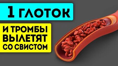 Как чистить тромбы