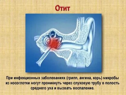 Отит после ангины