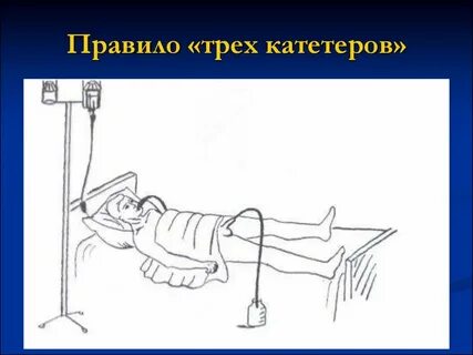 Принцип 3 4 5