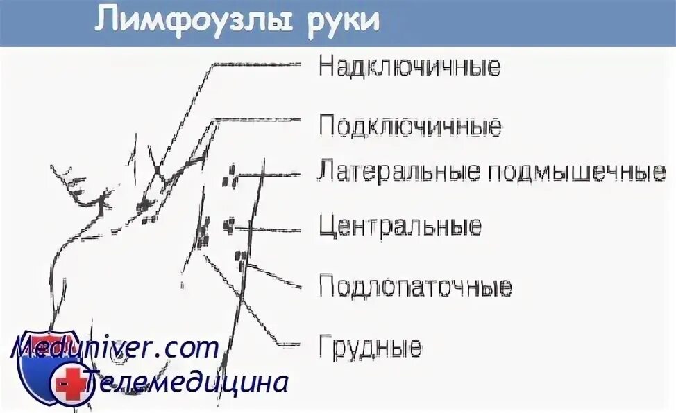 Норма аксиллярных лимфоузлов. Подмышечные лимфоузлы схема расположение.