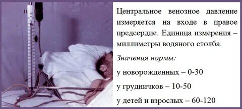 Показатель венозного давления