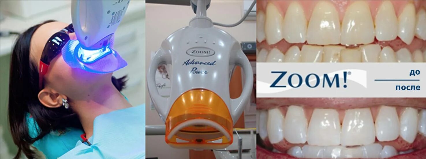 Фотоотбеливание зубов zoom3. Аппарат для отбеливания зум4.