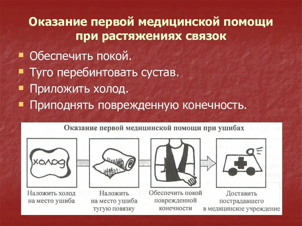 Какую первую помощь оказывают при растяжении. Алгоритм оказания первой медицинской помощи при растяжении связок. алгоритм оказания пмп при растяжении. алгоритм оказания помощи при повреждения связок. правила оказания первой помощи при растяжении.