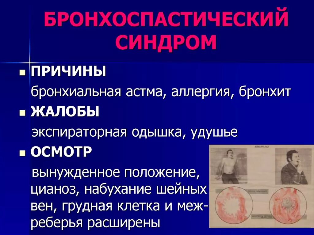 Бронхоспастический синдром. Синдром бронхоспазма клиника. Синдромы при бронхиальной астме. Бронхоастматический синдром. Аллергия и бронхит