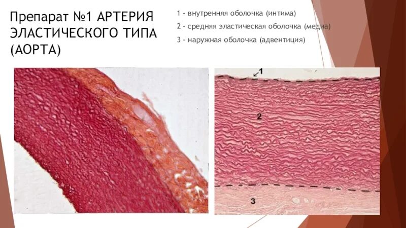 Картинки АОРТА ТКАНЬ