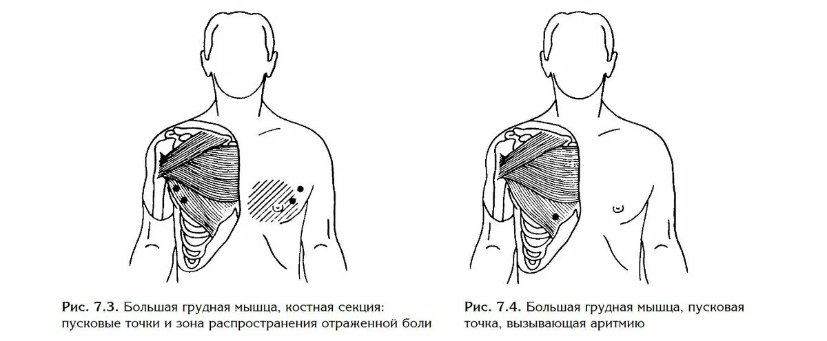 Большая грудная. Большая грудная мышца. Куда крепится грудная мышца. Ключичный отдел грудных мышц.