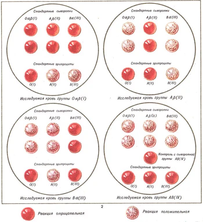 Методы определения группы крови стандартными эритроцитами. Перекрестный метод определения группы крови. Реакция агглютинации при определении группы крови. Методика определения групп крови перекрестным методом. Как отличить кровь