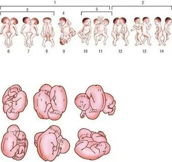 33 неделя положение плода
