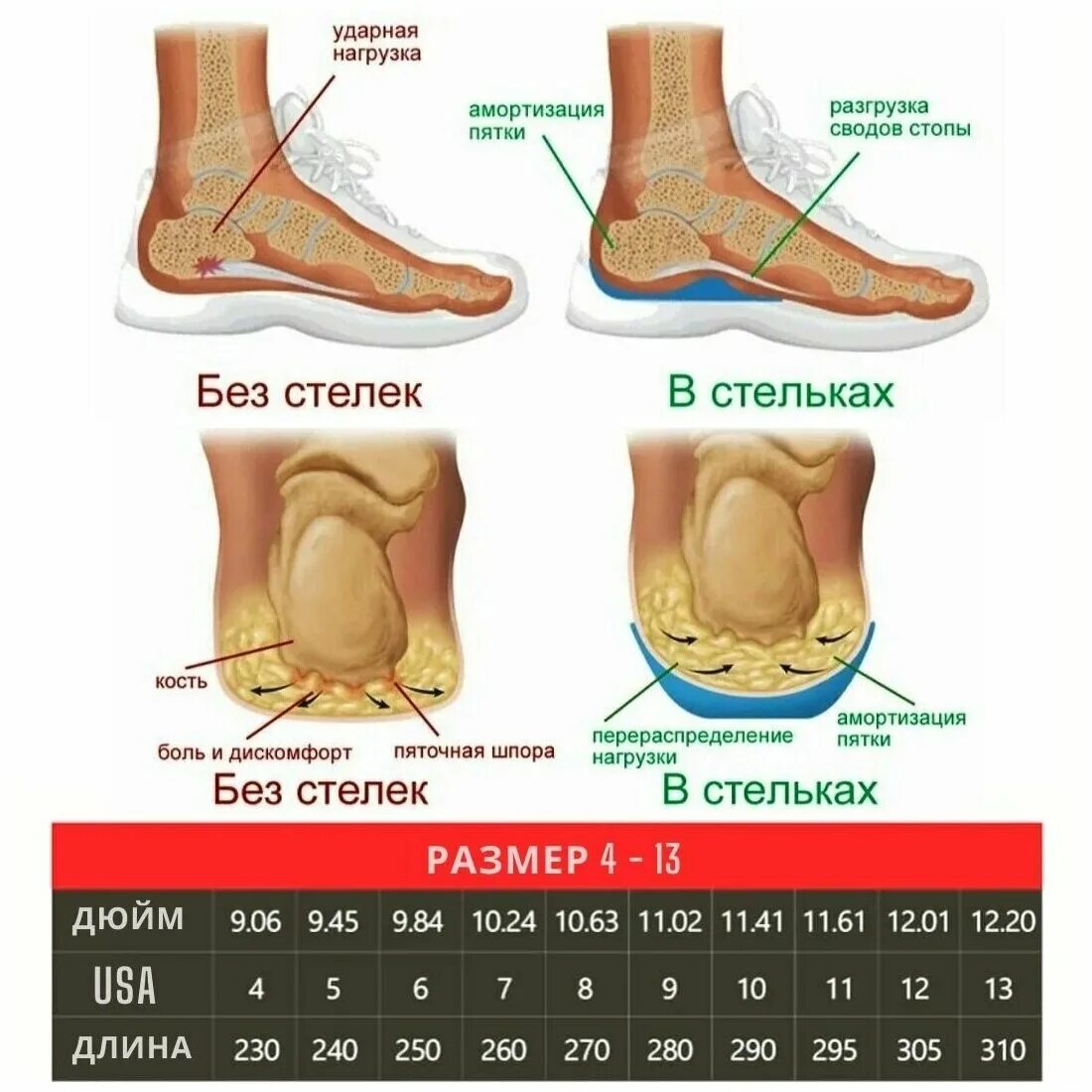 Ортопедические стельки вред мнение врачей. Строение ортопедической стельки. Ортопедические стельки отзывы покупателей. Ортопед стельки при поперечно продольном плоскостопии отзывы. Ортопедические стельки отзывы польза и вред мнение врачей.
