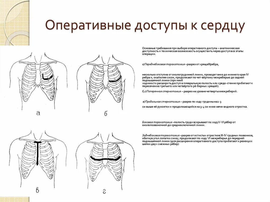 Поперечная стернотомия техника операции. Торакотомия. Оперативные доступы к легким.. Оперативные доступы к сердцу. Доступ к сердцу при операции. Боли грудной клетки после операции