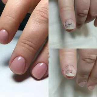 Гель лаком ногтевой пластины