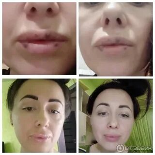 Без увеличения