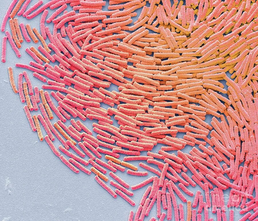 Язва под микроскопом. Язва под микроскопом. Язва под микроскопом. Бациллы сибирской язвы микроскопия. Бацилла антрацис сибирская язва.