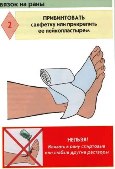 Как снять рубашку при ранении правой руки #госпитальная_хирургия_14_тема@otv6k Выбор лечебных мероприятий проникающих ране