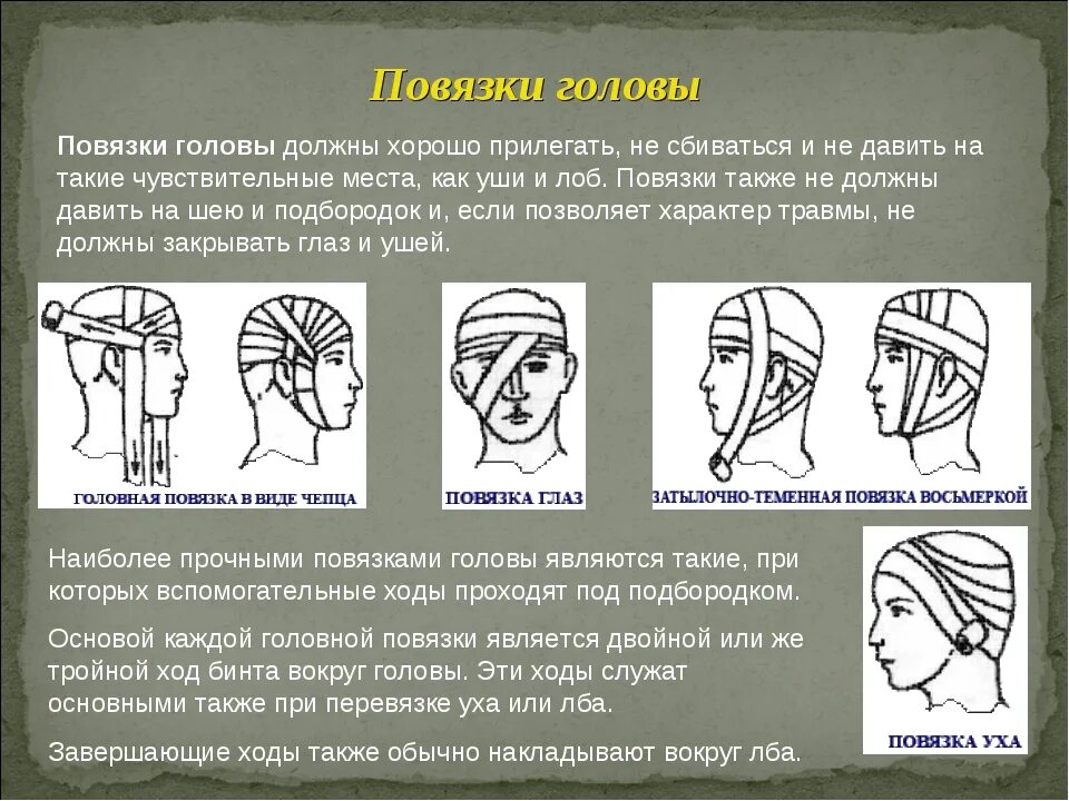 Наложение повязки при черепно-мозговой травме. Повязка на голову при травме. Наложение повязки при травме головы. Типы перевязки головы.