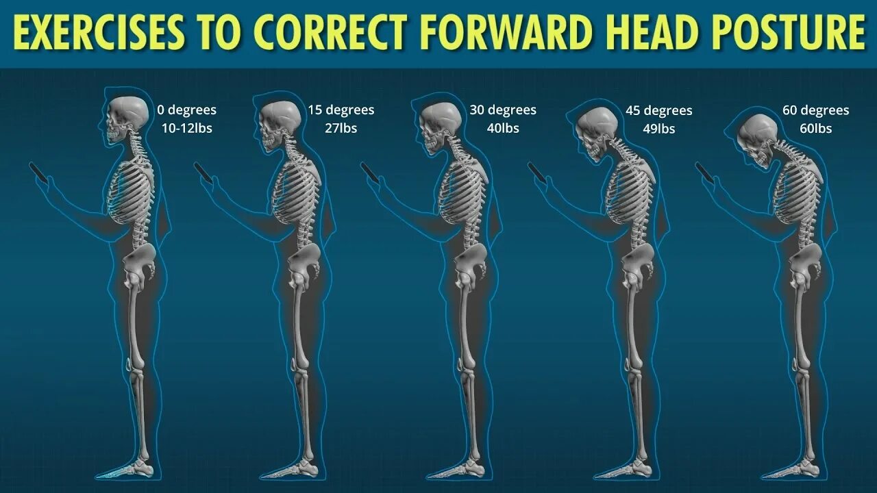 Neck forward. Выровнять спина шея. Put the words below under the correct headings 5 класс. Forward head posture exercises. Forward head posture.