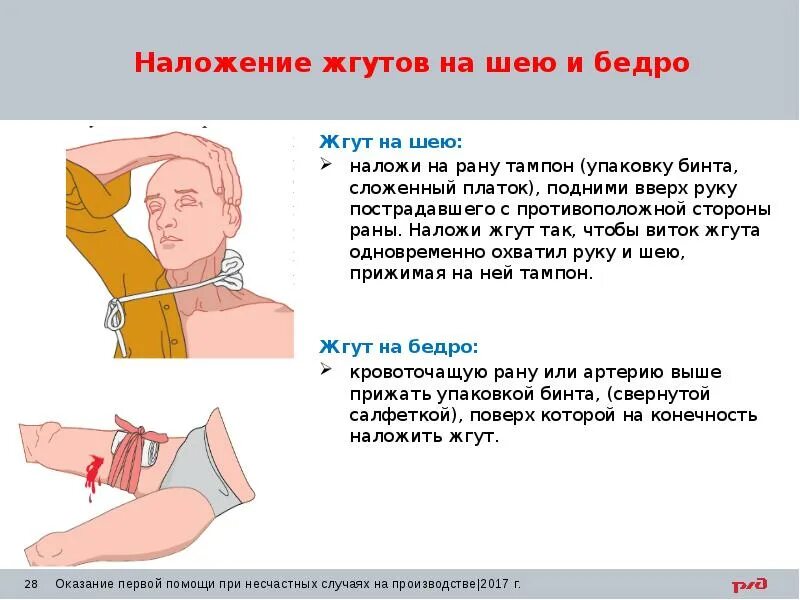 Остановить кровотечение на сонной артерии ответ тест. Надожегие жгута натшею. Наложение жгута при ранении шеи. Жгут на шею накладывают. Наложение жгута при кровотечениях на шею.