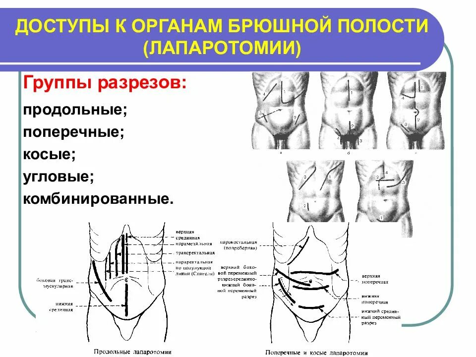 Области брюшной стенки живота. Топография передней брюшной стенки Оперативная хирургия. Грыжа передней брюшной стенки сбоку. Грыжа передней стенки живота топографическая анатомия. Грыжа средней линии передней брюшной стенки.