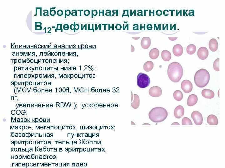 Абсолютные ретикулоциты повышены. Ретикулоциты при в12 дефицитной анемии. Анализ крови при b12 дефицитной анемии. В12 анемия анализ крови показатели. Анализ крови при анемии в12 дефицитной анемии.