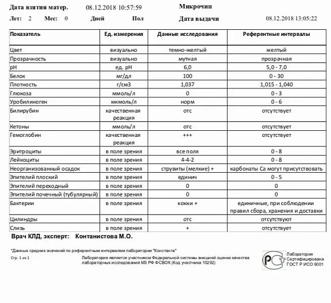 Уробилиноген и стеркобилиноген. Билирубин и уробилиноген в моче. Уробилиноген норма в моче в мкмоль/л. Повышение уробилиногена в моче причины. Уробилиноген количественно.