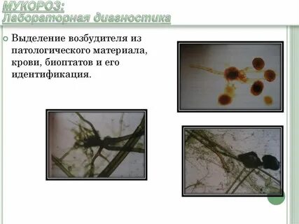Возбудитель выделяет
