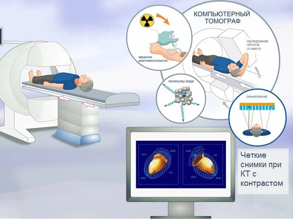 Разница кт и кт с контрастом. Мультиспиральная компьютерная томография схема. Схема рентгеновской компьютерной томографии. Схема томографа кт. Основные компоненты кт.