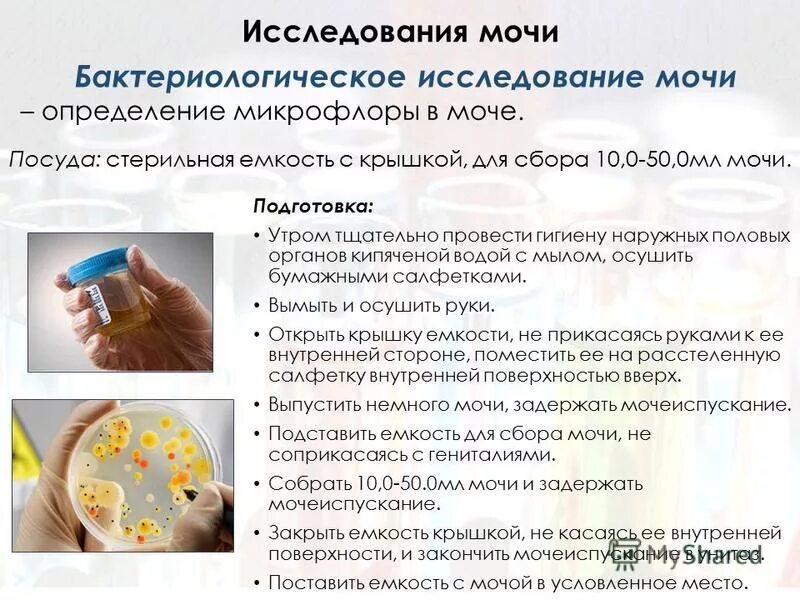 Обязательно ли бактериологическое. Памятка бактериологическое исследование мочи (посев мочи). взятие мочи на бактериологическое исследование. бактериологическое исследование мочи посев. бак исследованиетмочи.