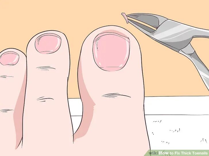 Как подстричь ноготь на пальце. Правильно подстриженные ногти на ногах. Обрезание ногтей на ногах. Обрезает ногти на ногах. Правильная обрезка ногтей на ногах.