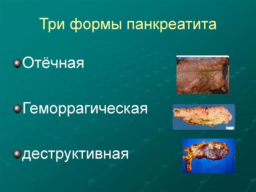 Осложнения острого панкреатита диагностика. Ранние осложнения острого панкреатита. Стадии заболевания острого панкреатита. Гнойно-септические осложнения острого панкреатита. Острый панкреатит макропрепарат.