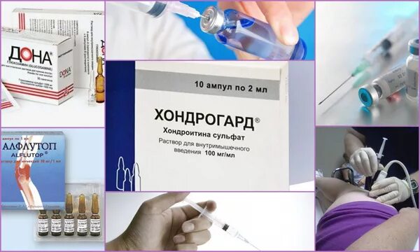 Обезболивающие уколы при коксартрозе тазобедренного сустава 3. Обезболивающие уколы при болях в суставах. От боли суставах уколы в ампулах. Уколы от боли и воспаления в суставах внутримышечно. Что колят в суставы