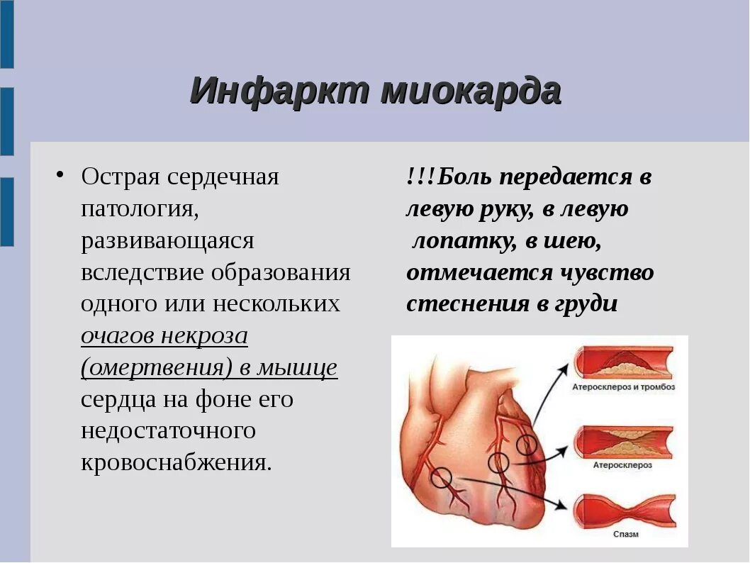 Инфаркт причины симптомы. Острый инфаркт миокарда симптомы. Заболевания сердечно сосудистой системы инфаркт. Патологии сердца инфаркт миокарда. Болезни сердца презентация.