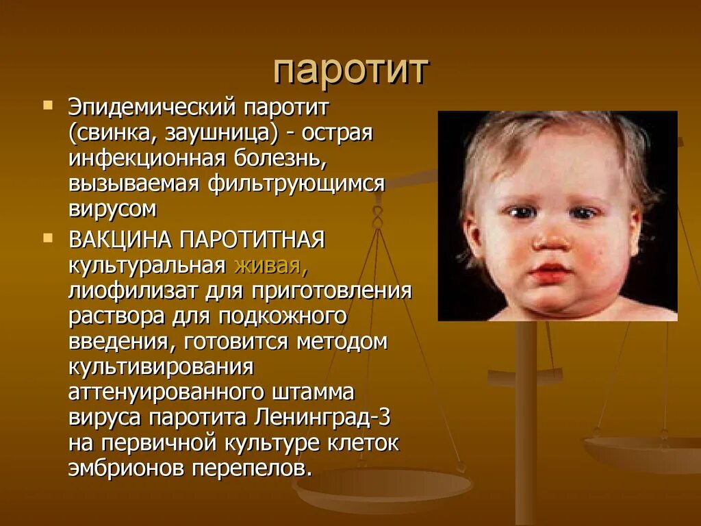 Свинка эпидемический паротит. Эпидемический паротит характеризуется. Эпидемический паротит Свинка симптомы. Свинка признаки болезни у детей симптомы