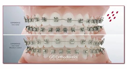 Experience система. Experience Mini Metal GC Orthodontic. Самолигирующие брекеты экспириенс. Experience Metal и Mini Metal брекеты.