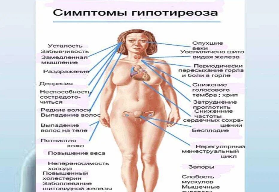 Можно ли при заболевании щитовидной железы. Что такое гипотиреоз щитовидной железы у женщин. тиреоидные гормоны при гипотиреозе. гипотериоз щитовидки у женщин симптомы. симптомы гипотиреоза щитовидки.