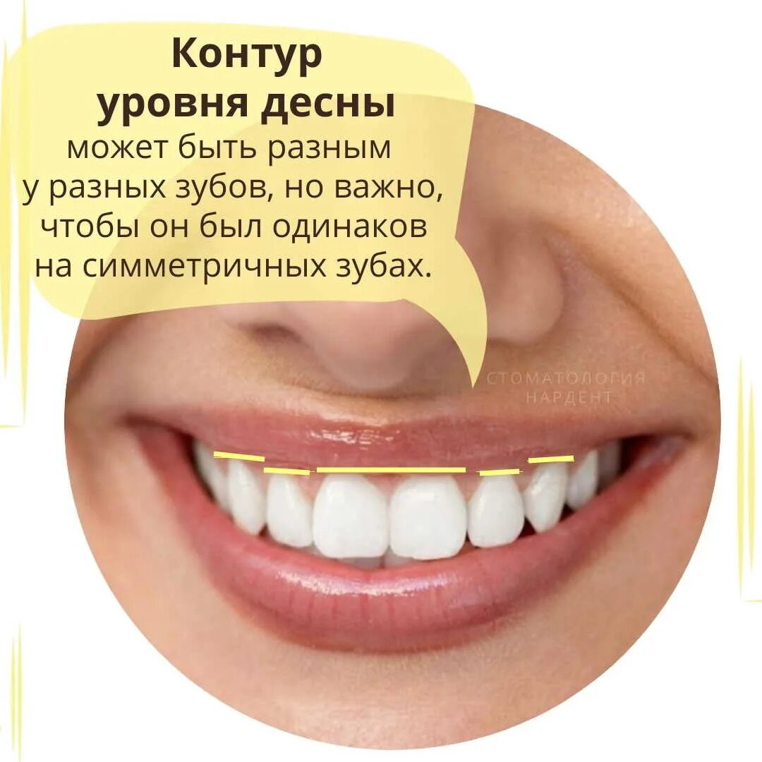 Изгиб зубов. Идеальные зубы. Красивая форма зубов. Линия улыбки стоматология.
