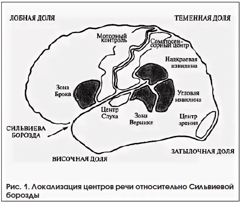 Левая средняя мозговая артерия инсульт. Сильвиева борозда на кт. Речевые центры локализуются в.