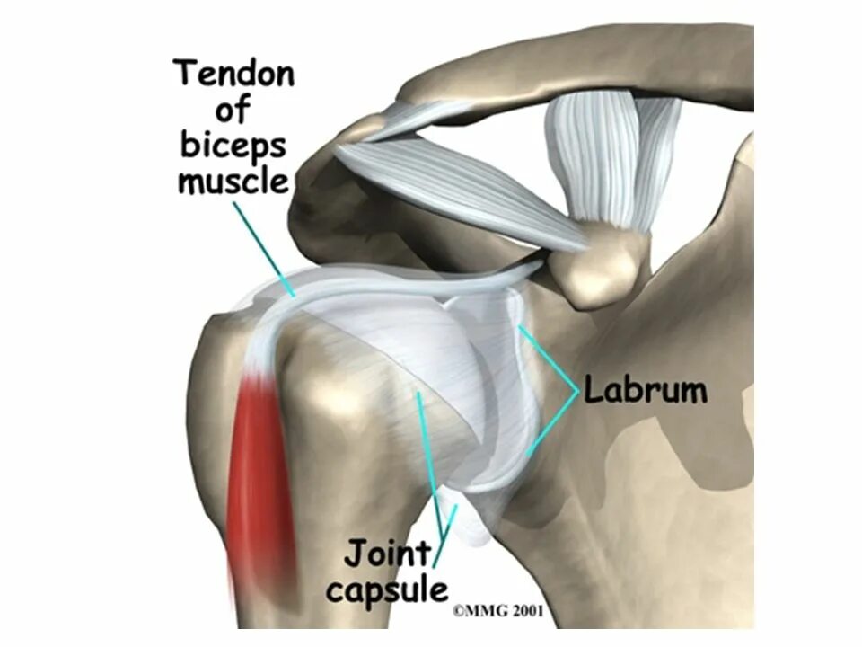 Тендинит сухожилия надостной. Ротаторная манжета плечевого. Сухожилия ротаторной манжеты плеча. Анатомия плеча мышцы связки сухожилия. Ротаторная манжета плеча.