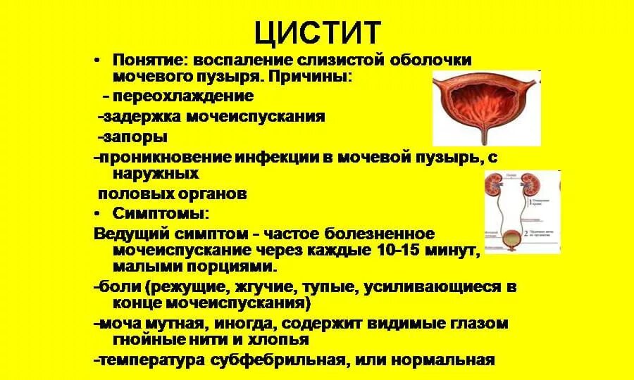 Симптомы мочевого пузыря у мужчин признаки. Воспалительные заболевания мочевого пузыря. Цистит воспаление мочевого пузыря. Цистит мочевого пузыря у женщин.