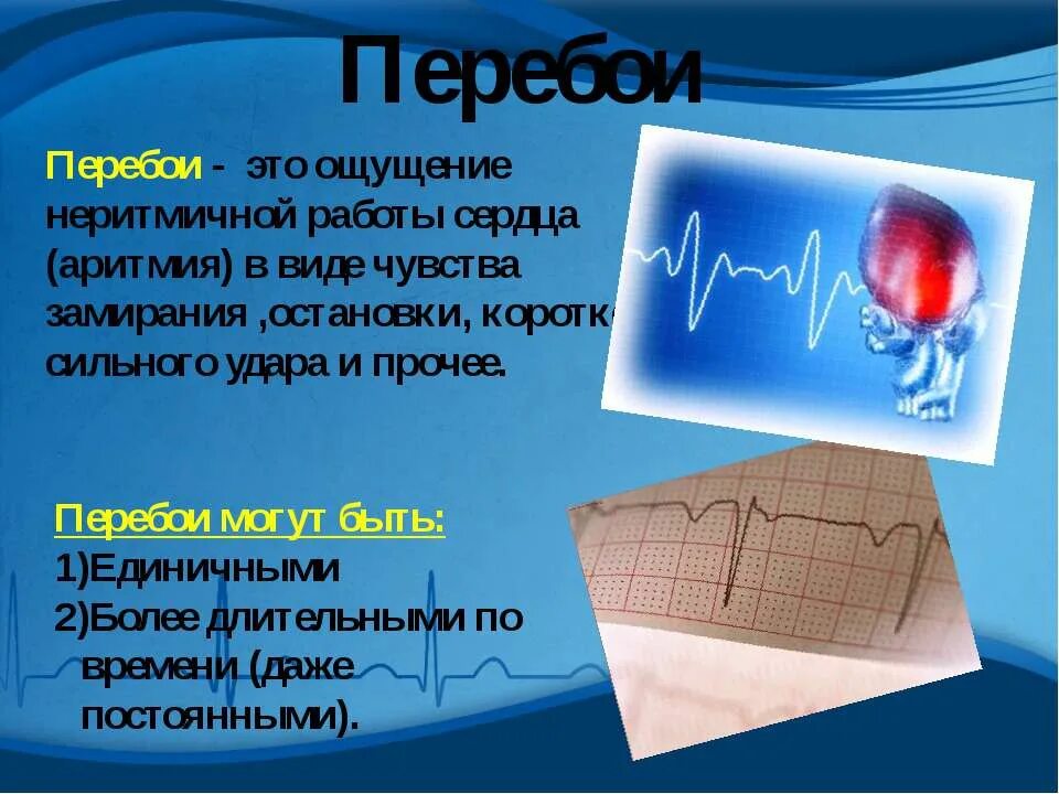 Сильно стучит сердце что делать. Перебои в работе сердца. Перебои ритма сердца. Ощущение замирания сердца. Чувство остановки сердца.