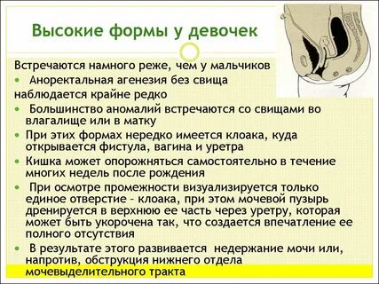 Аноректальные пороки у детей