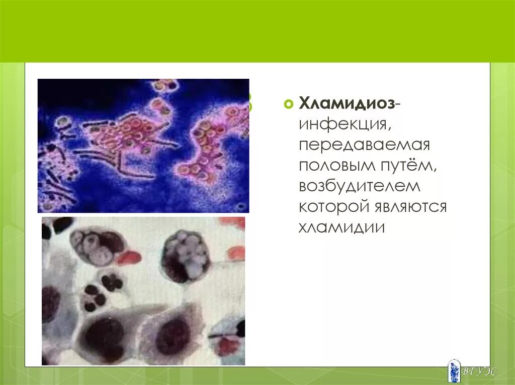 Хламидиоз передается через. Возбудители хламидийной инфекции это. Возбудитель урогенитального хламидиоза. Возбудитель инфекции генитальный хламидиоз.