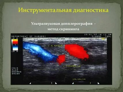 Атеросклероз нижних конечностей узи