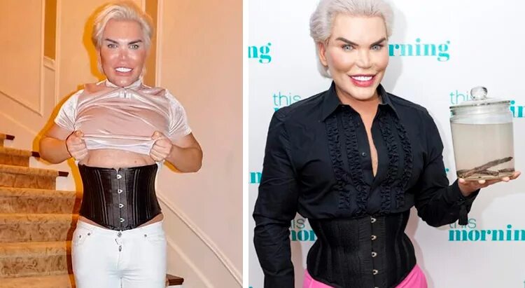 валерия лукьянова талия. талия с удаленными ребрами. живой кен родриго. пикси фокс до и после пластики. родриго алвес.